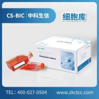 NCI-H295R-LUC-GFP-Puro双标记的人肾上腺皮质腺癌细胞