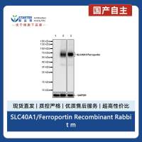 SLC40A1/Ferroportin Recombinant Rabbit mAb (S-2172-35)