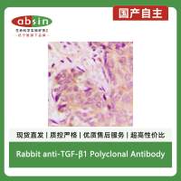 Rabbit anti-TGF-β1 Polyclonal Antibody