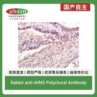 Rabbit anti-AIM2 Polyclonal Antibody