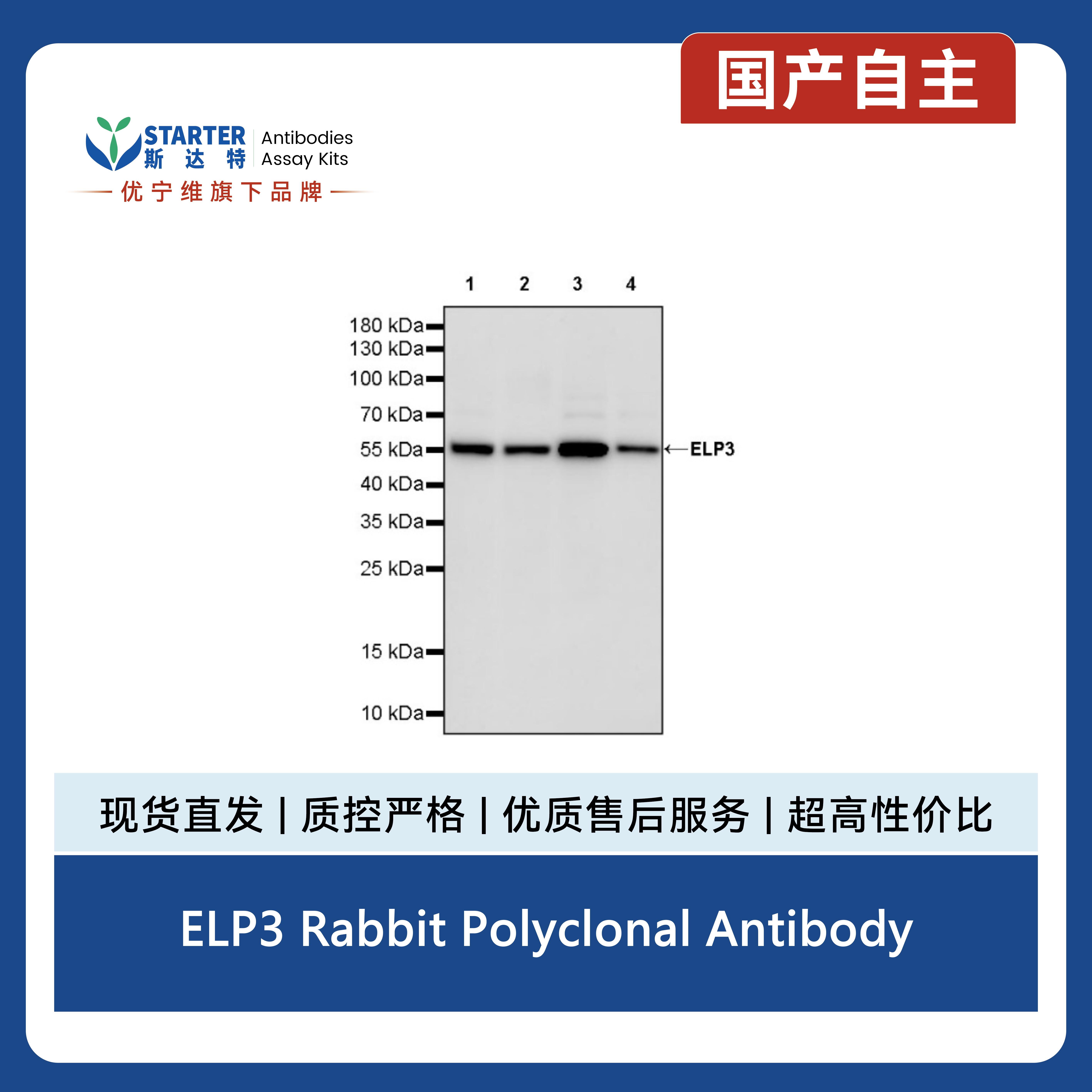 ELP3 Rabbit Polyclonal Antibody产品图