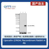 Lipocalin-2/NGAL Recombinant Rabbit mAb (S-2279-72)
