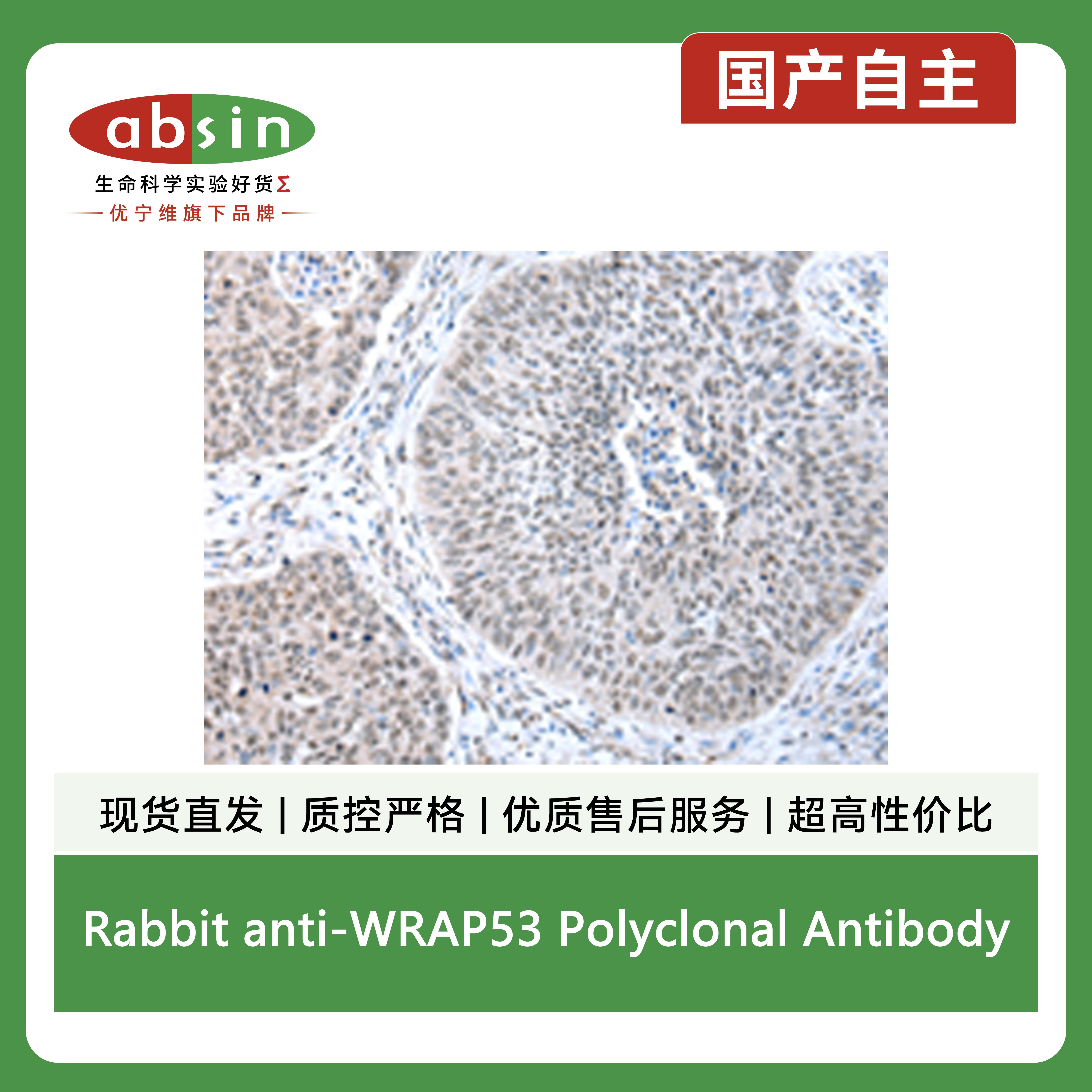 Rabbit anti-WRAP53 Polyclonal Antibody产品图