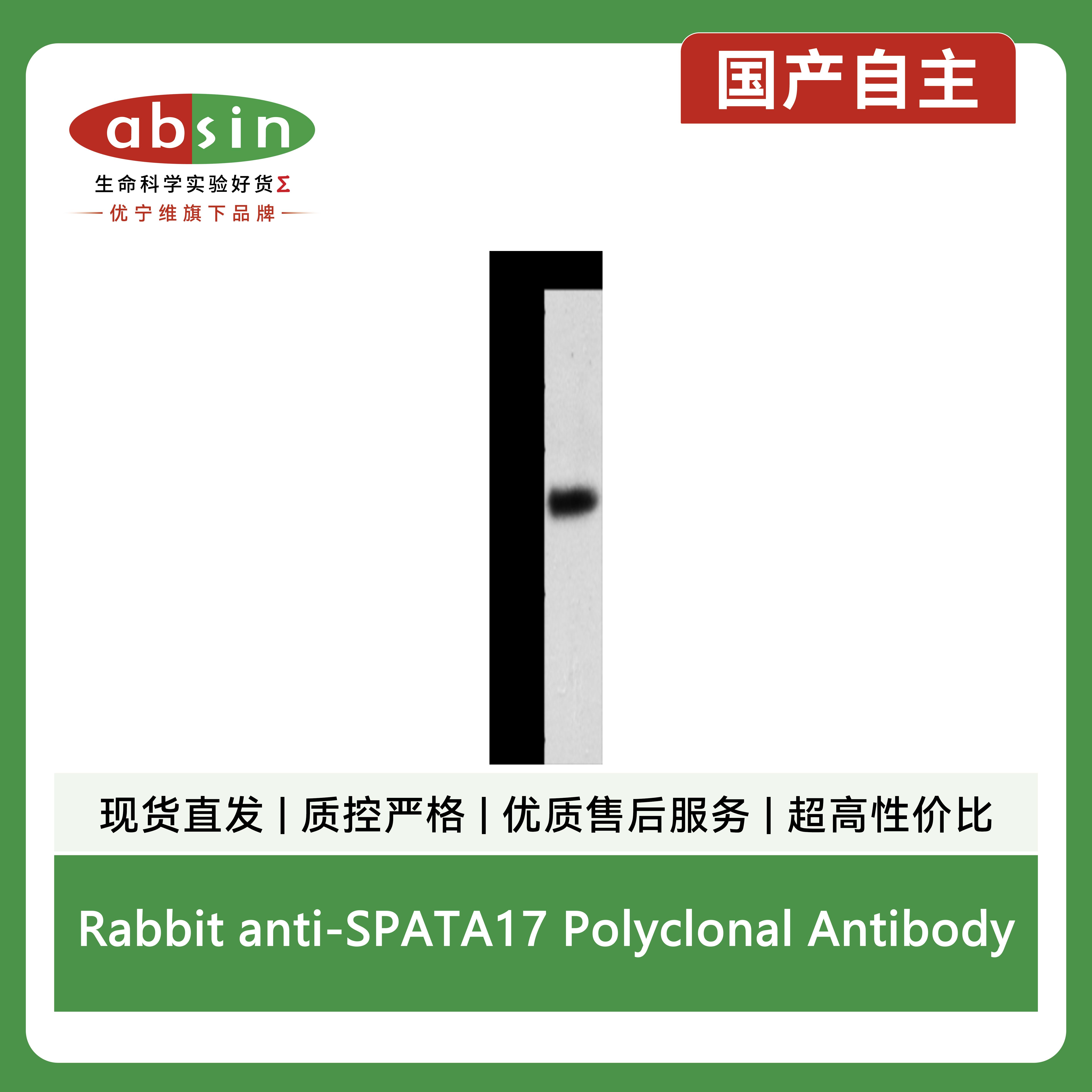 Rabbit anti-SPATA17 Polyclonal Antibody产品图