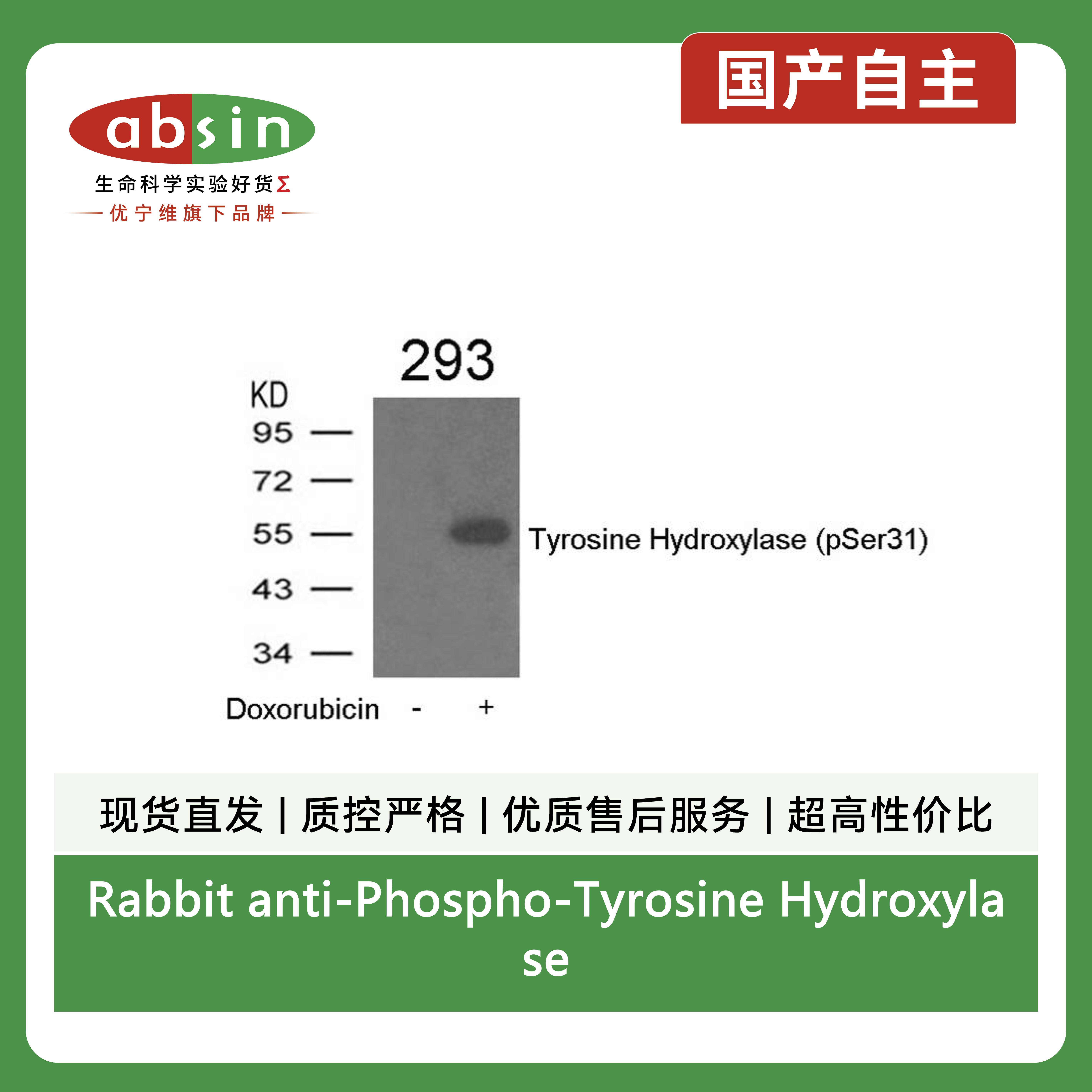 Rabbit anti-Phospho-Tyrosine Hydroxylase(Ser31)Polyclonal Antibody产品图