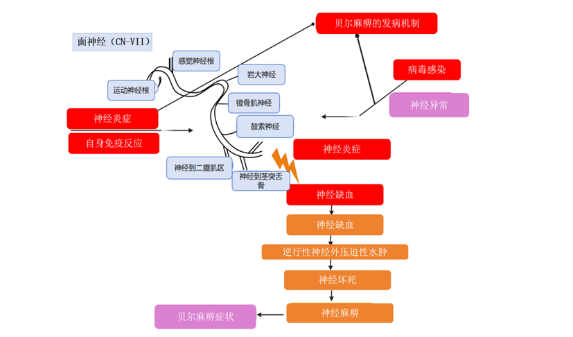 周围性面神经麻痹