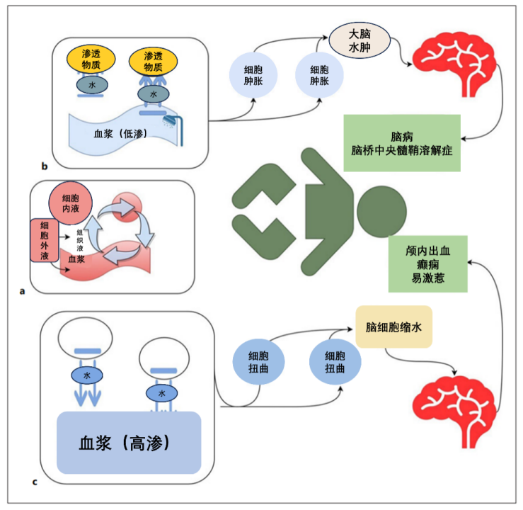 高钠血症