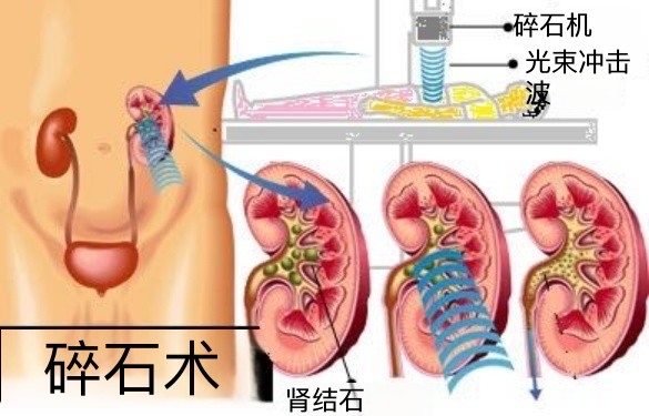 图片预览