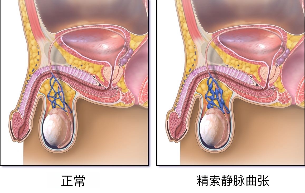 图片预览