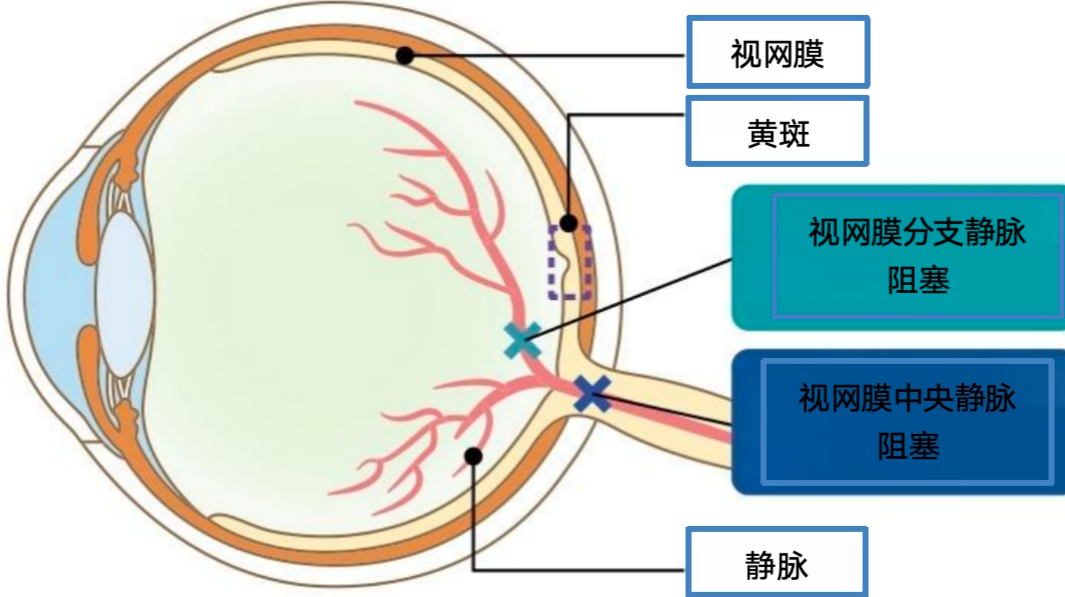 图片预览