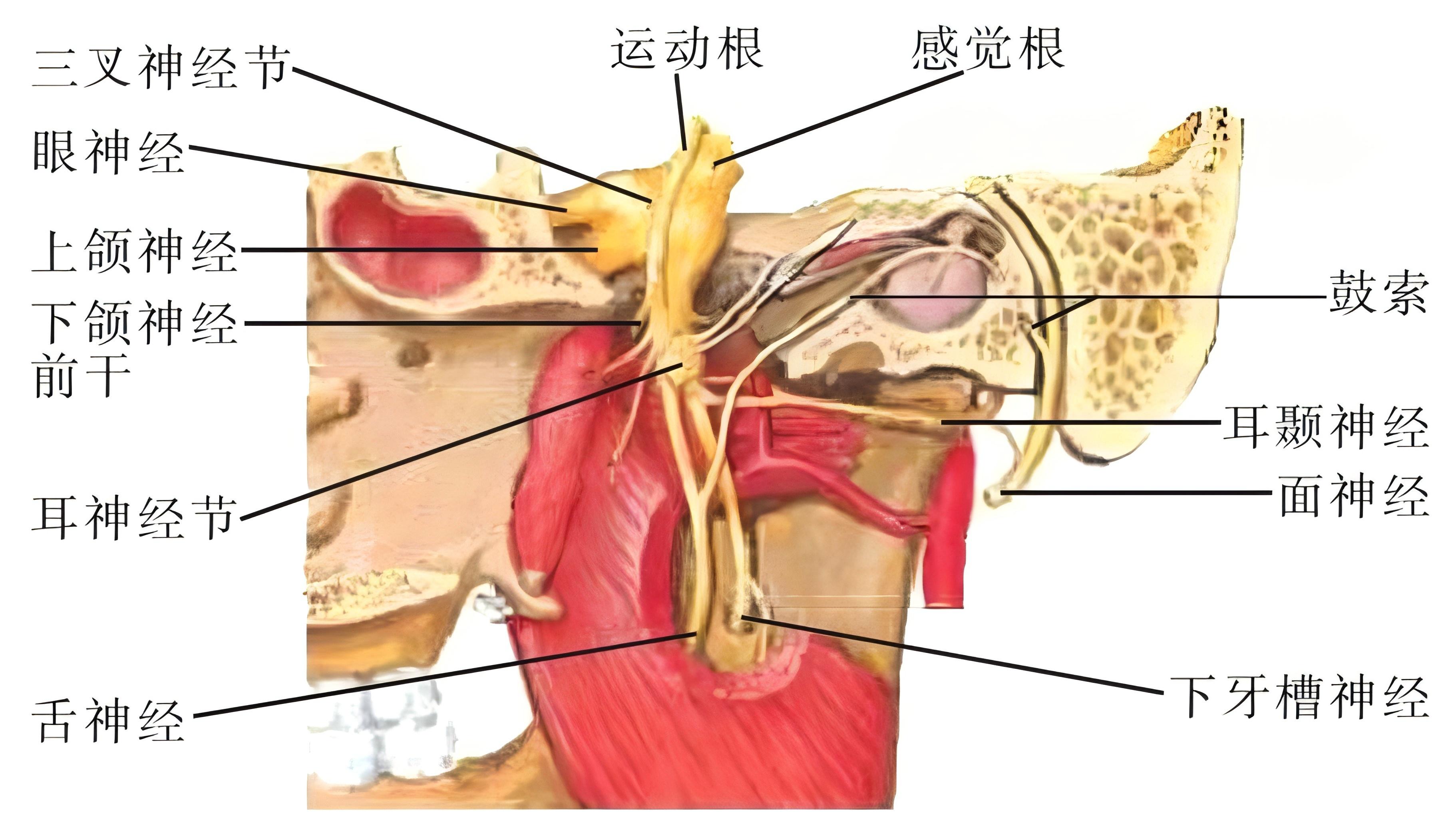 三叉神经痛