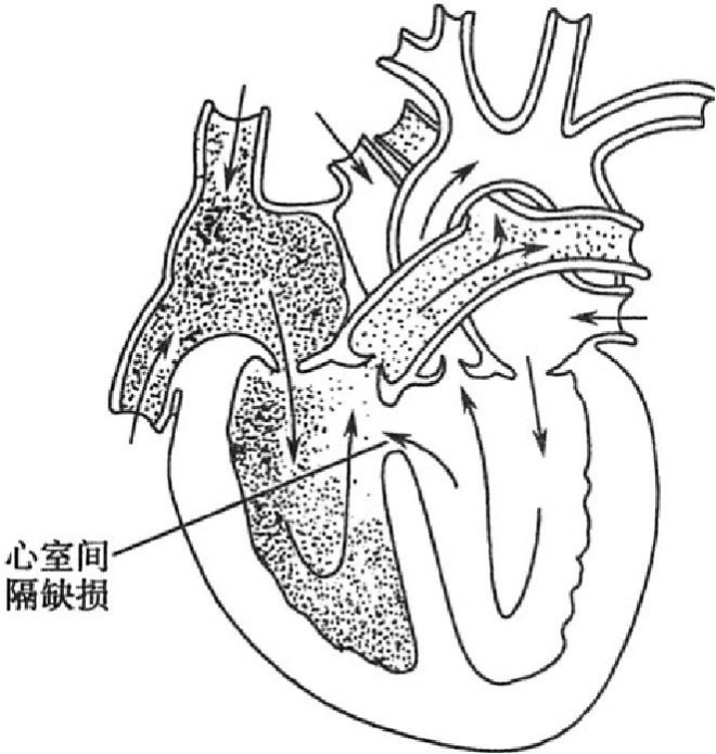图片预览