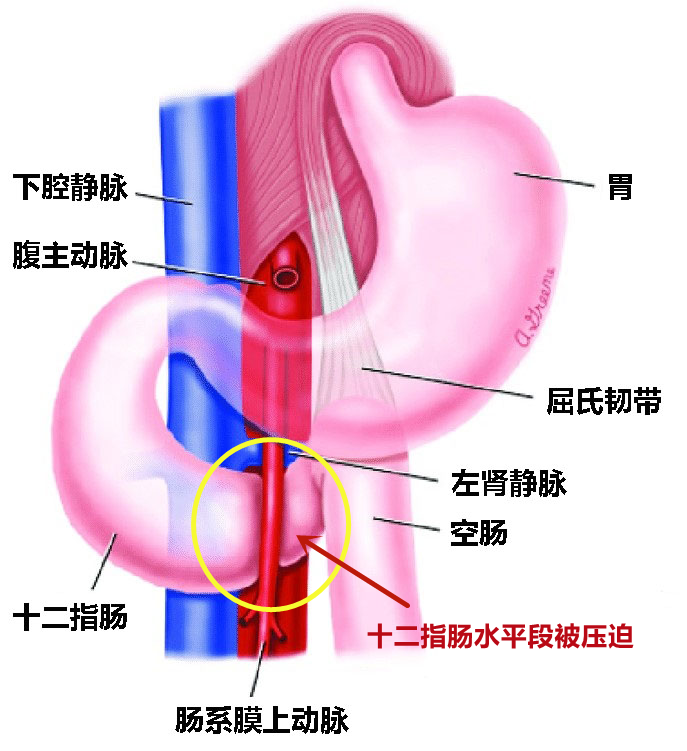 十八岁的她为何越吃越瘦？