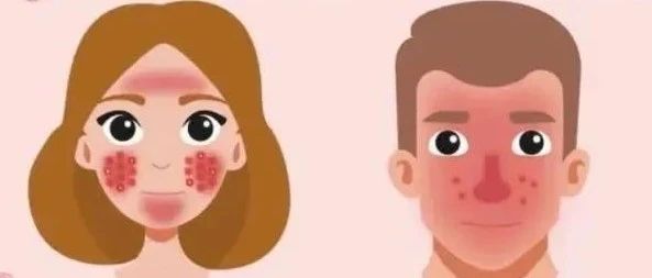 脸红≠敏感肌，带你正确认识玫瑰痤疮