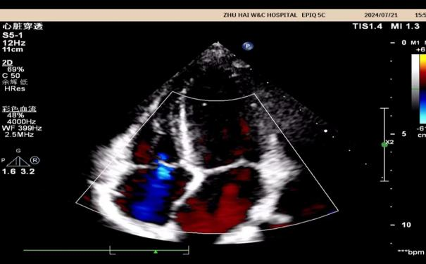 小探头,大世界——来给心脏「照个相」