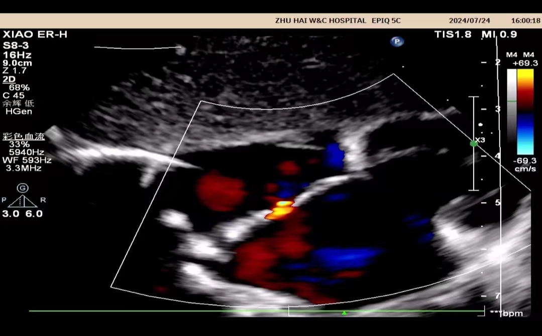 小探头,大世界——来给心脏「照个相」