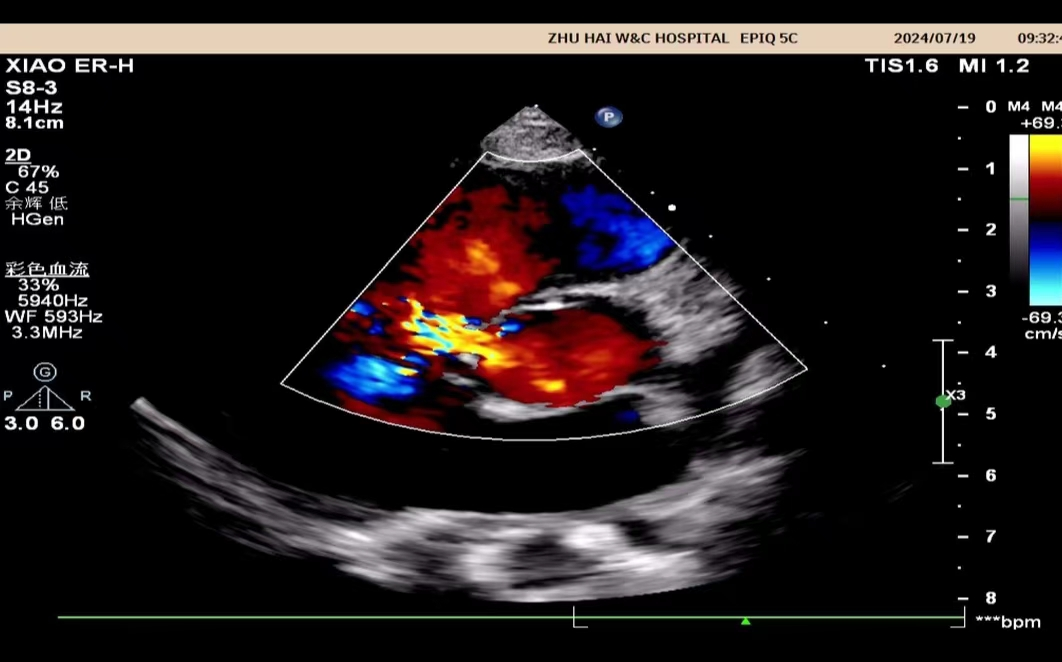 小探头,大世界——来给心脏「照个相」