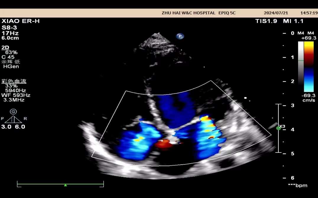 小探头,大世界——来给心脏「照个相」