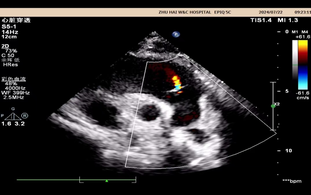 小探头,大世界——来给心脏「照个相」
