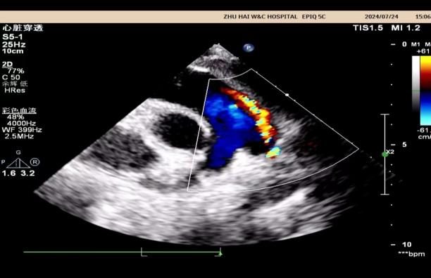 小探头,大世界——来给心脏「照个相」