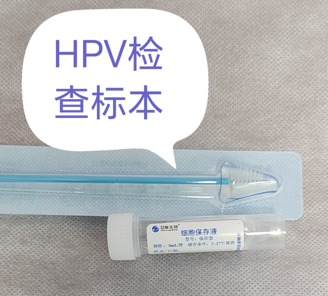 TCT 和 HPV 为什么要一起检查