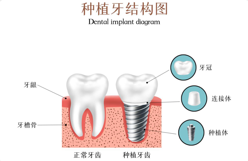 学他「逆天改命」你的牙也能重生！