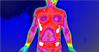 GTT 是什么？有辐射吗？