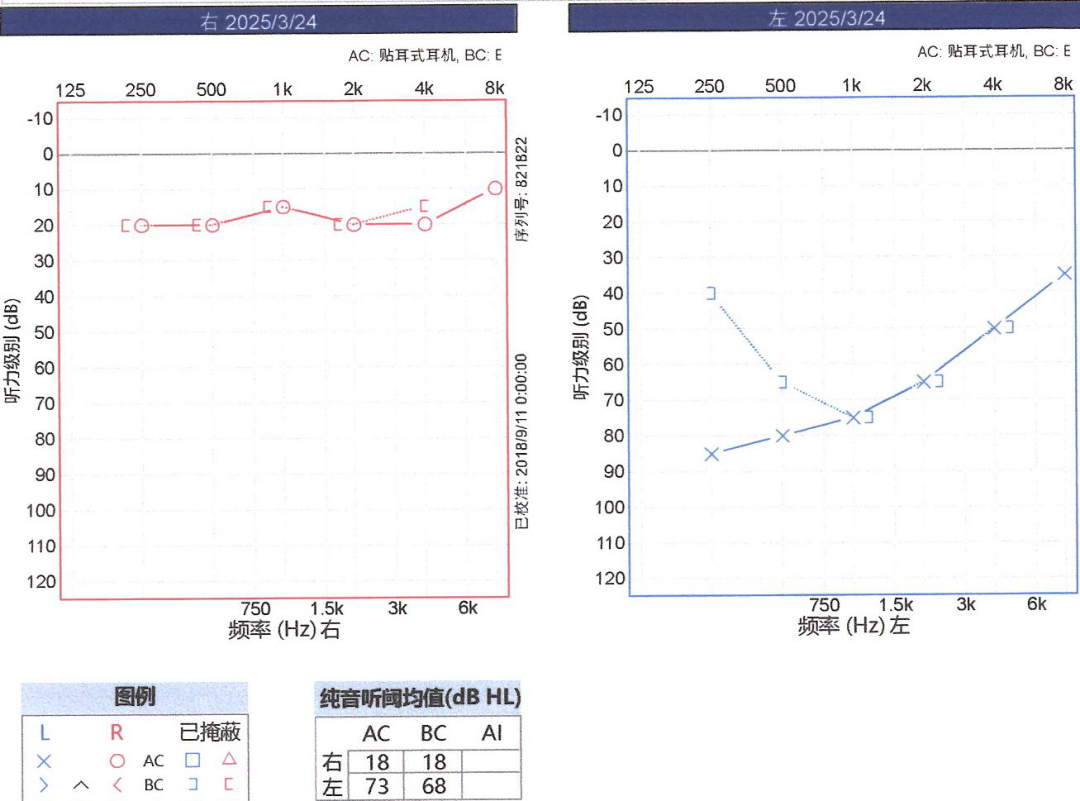19 岁小伙突然听不见了！
