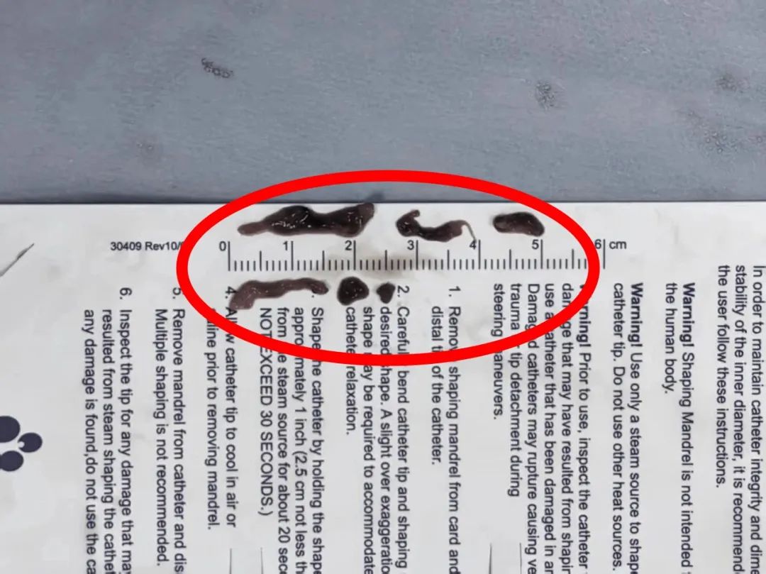 与死神赛跑!1 小时抢回「大脑」