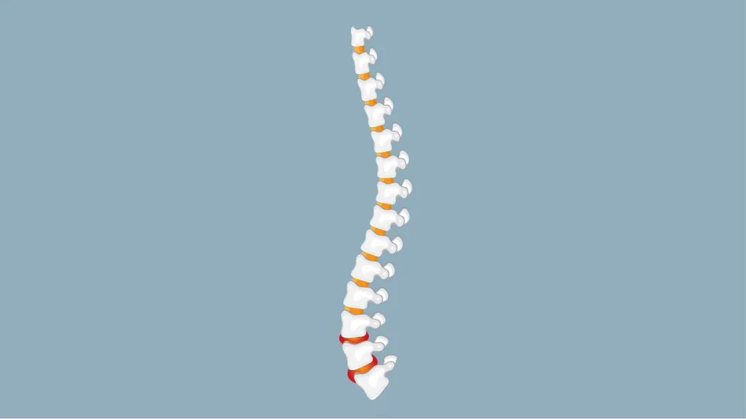 7 毫米！ 「抽」走腰痛病灶
