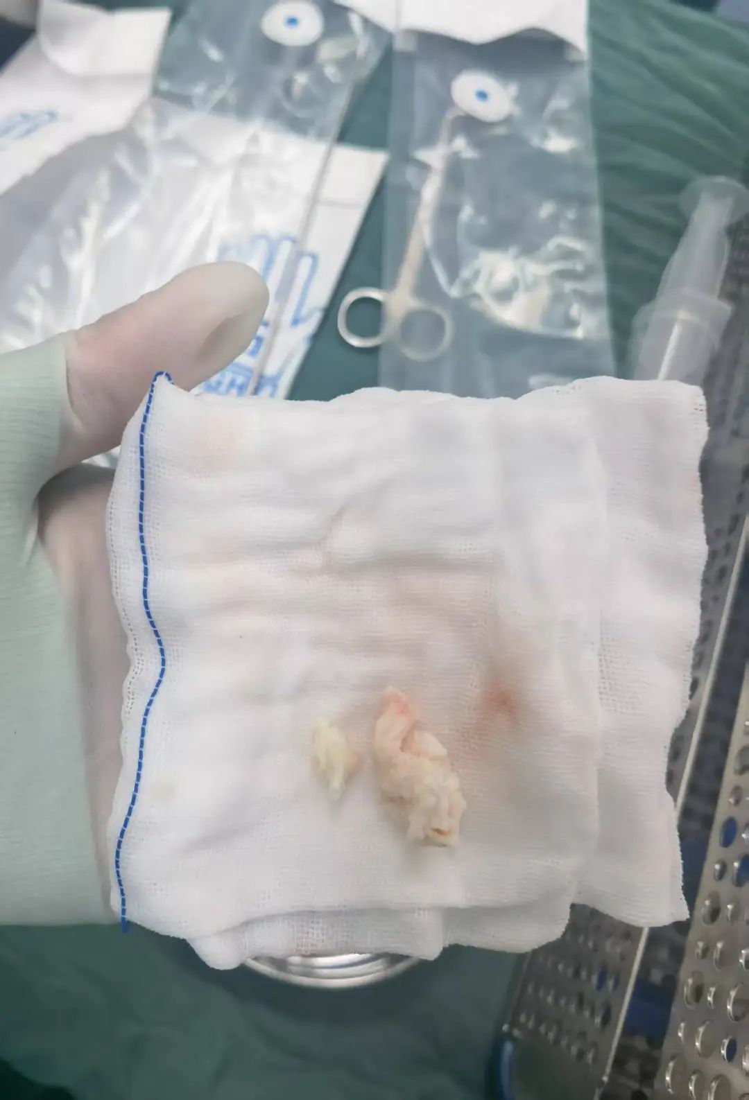 7 毫米！ 「抽」走腰痛病灶