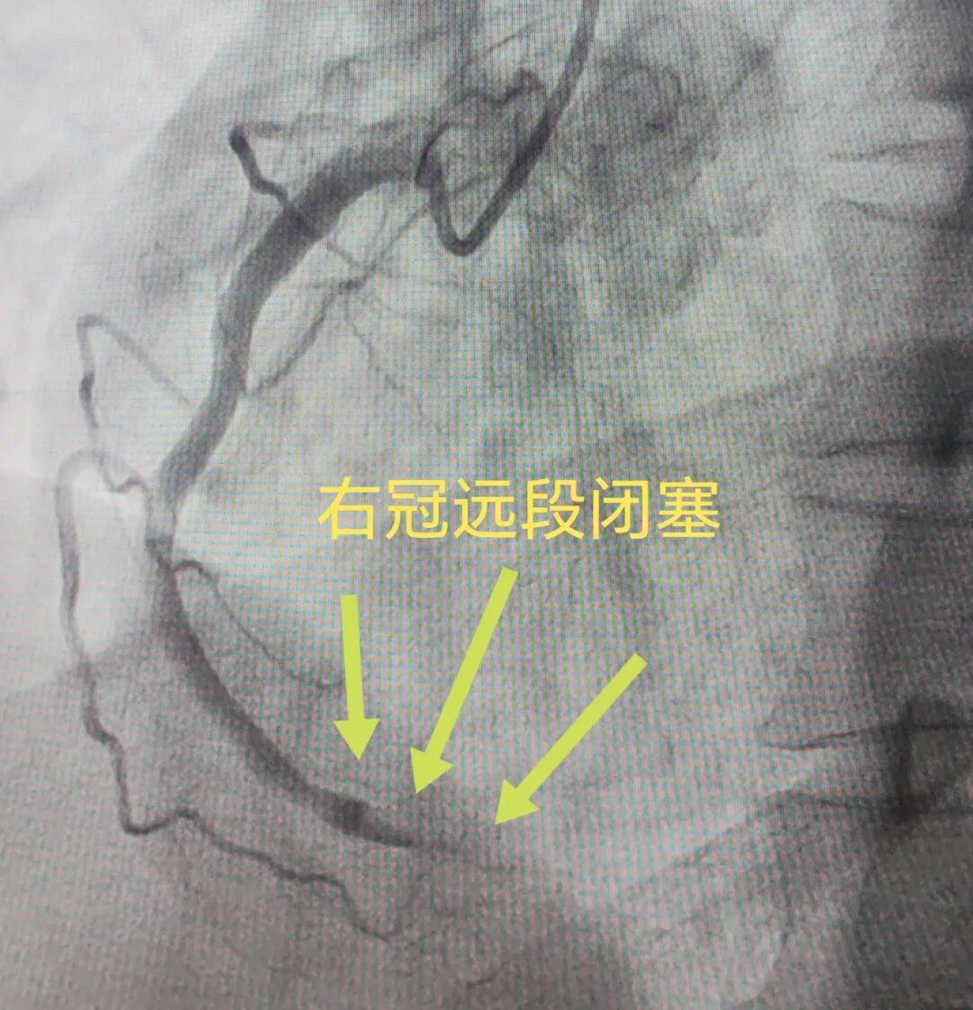 苏州京东方医院心血管内科参赛病例斩获「精彩病例」奖项