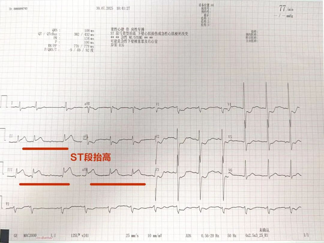 苏州京东方医院心血管内科参赛病例斩获「精彩病例」奖项