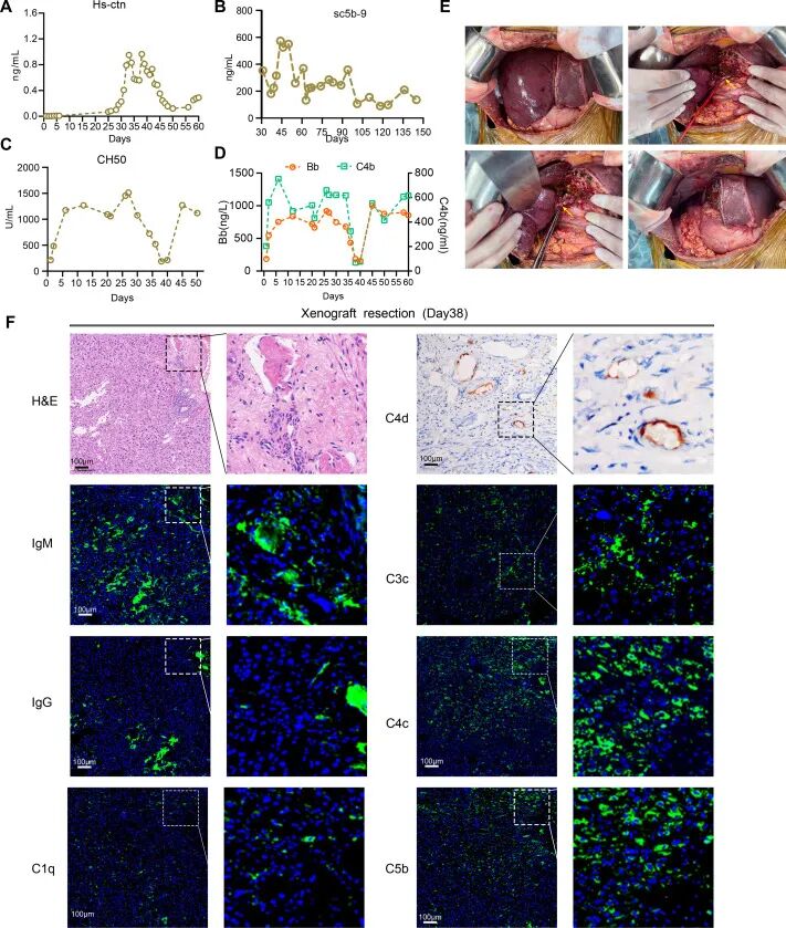 全球首例 | 安徽医科大学实现猪-人活体肝移植，基因编辑供肝存活 171 天