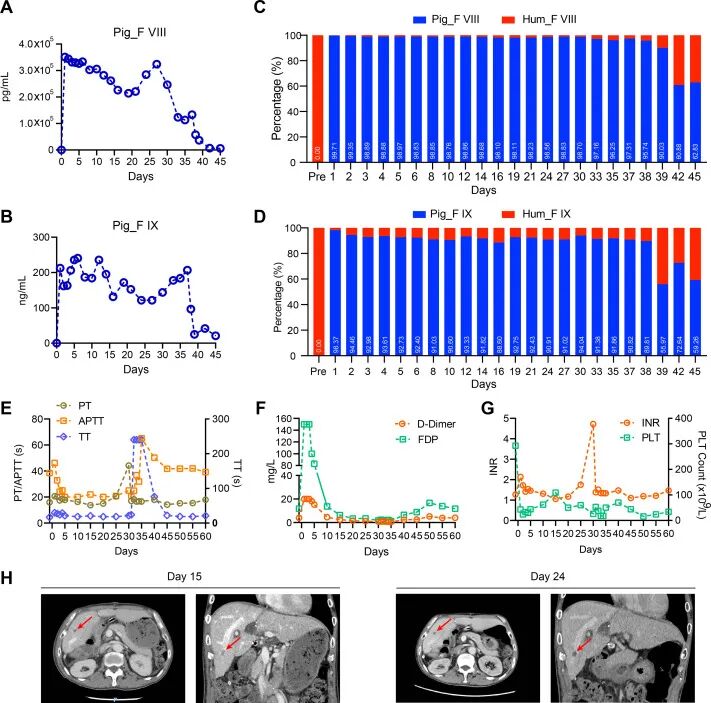 全球首例 | 安徽医科大学实现猪-人活体肝移植，基因编辑供肝存活 171 天