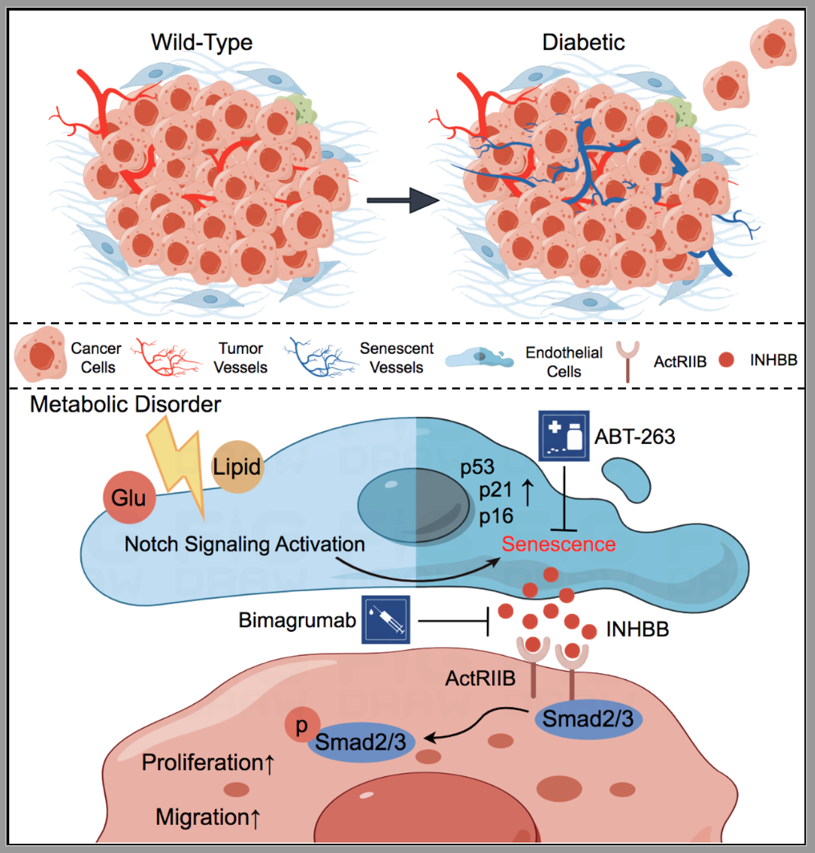 NC:空军军医大学王琳/窦科峰团队揭示衰老肿瘤血管内皮细胞促进糖尿病相关胰腺癌进展