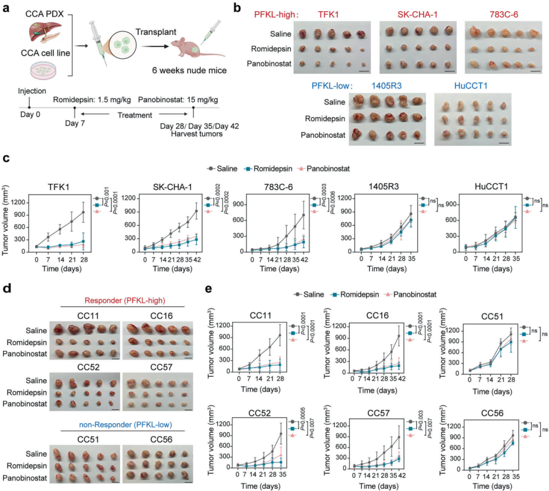 IF 52.7 | 海军军医大学王红阳院士团队肿瘤学领域取得新进展