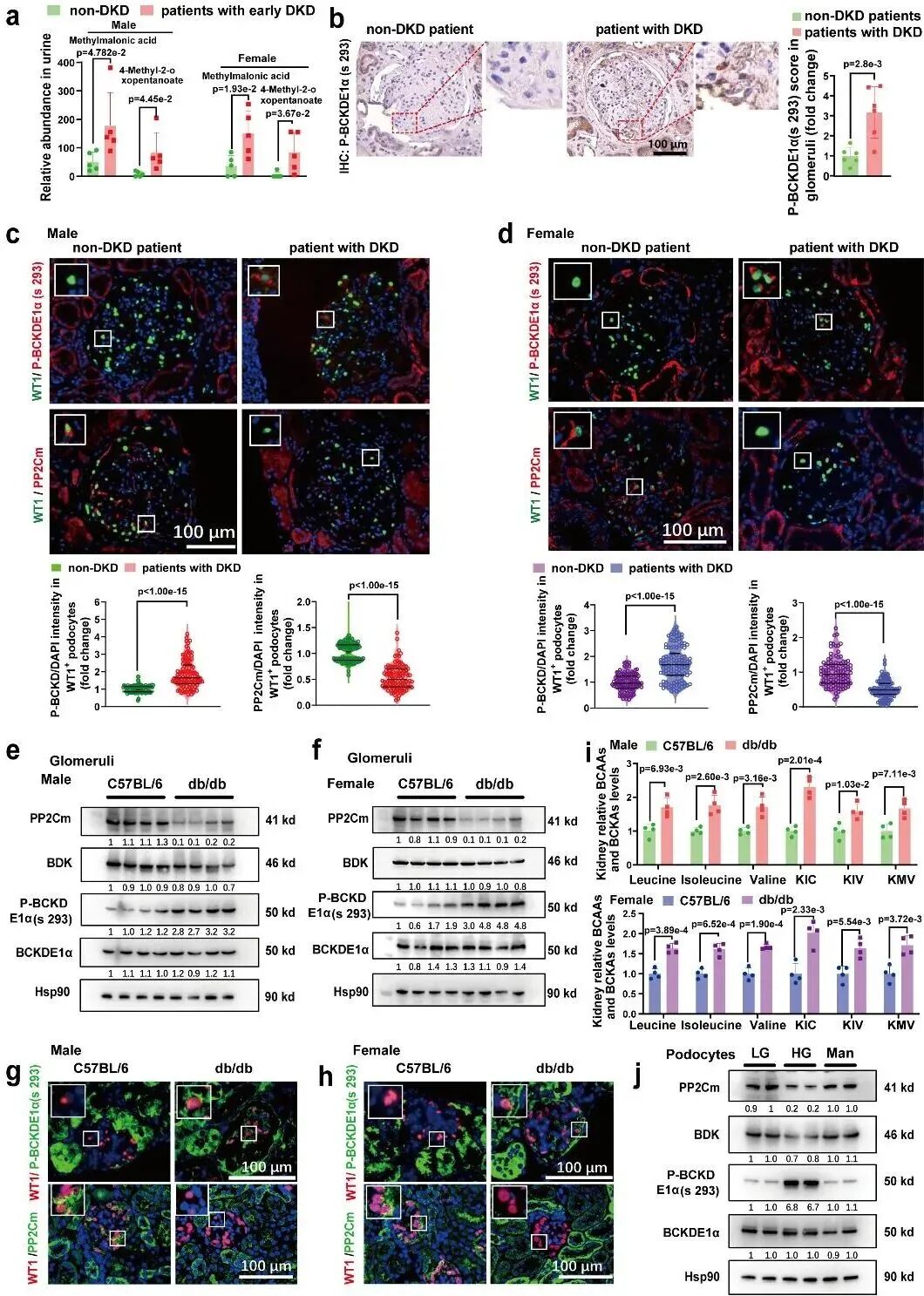 空军军医大学团队:发现支链氨基酸代谢障碍,驱动糖尿病肾病进展