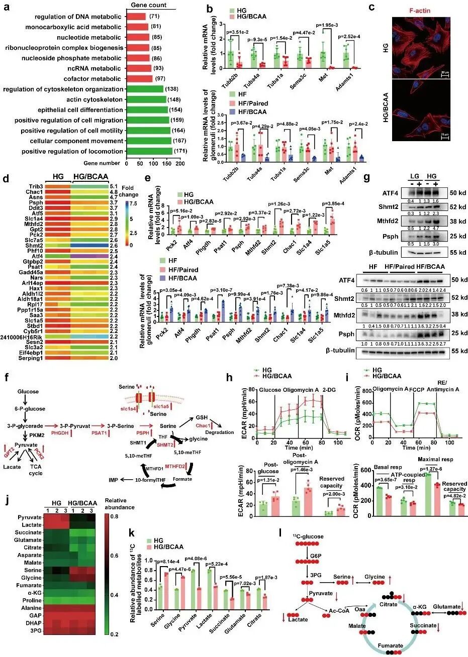空军军医大学团队:发现支链氨基酸代谢障碍,驱动糖尿病肾病进展