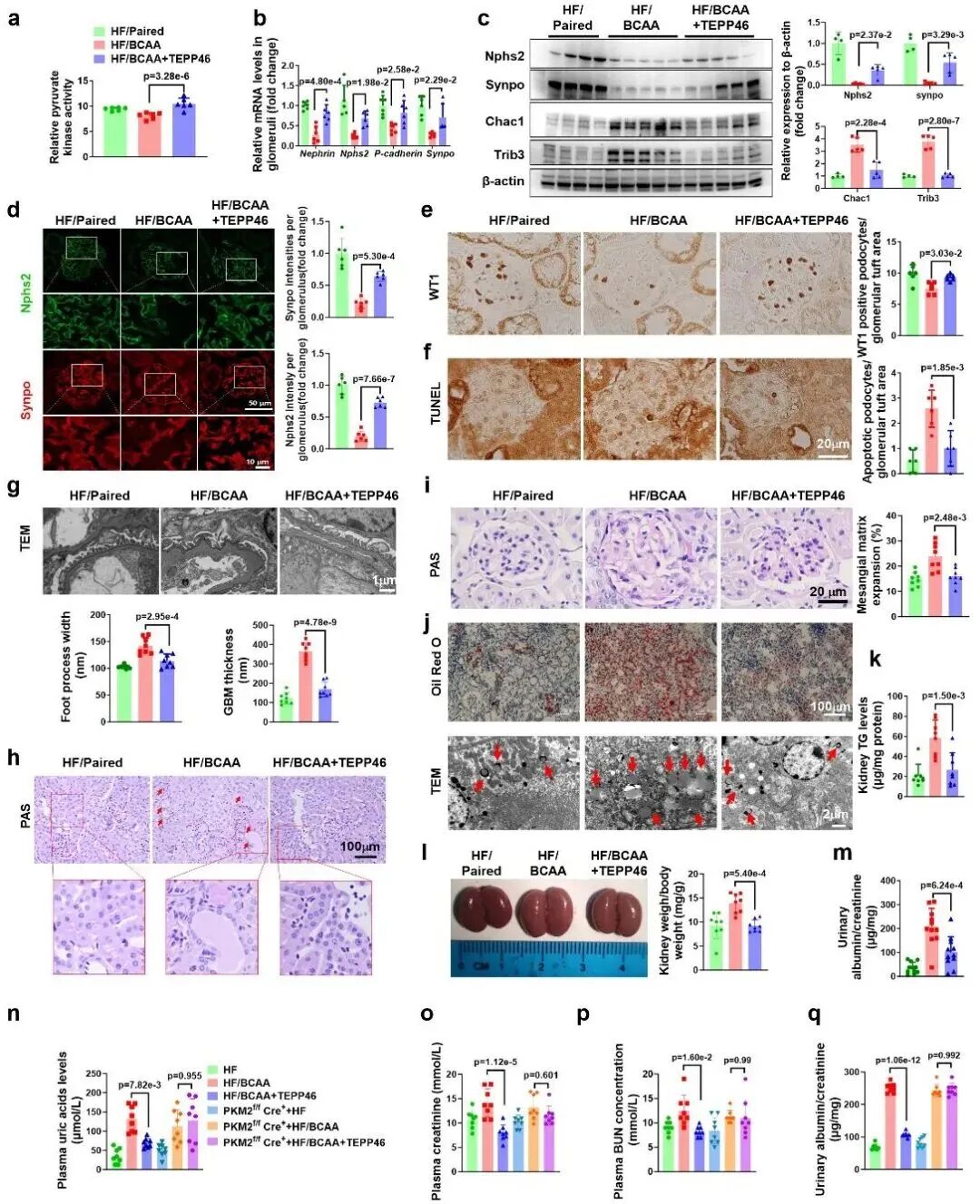空军军医大学团队:发现支链氨基酸代谢障碍,驱动糖尿病肾病进展