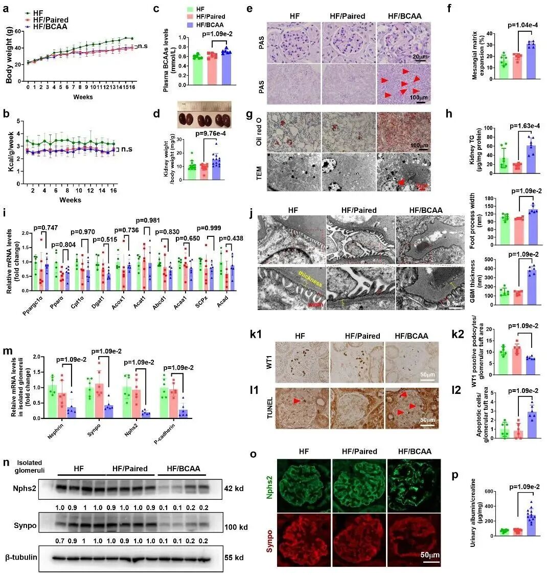 空军军医大学团队:发现支链氨基酸代谢障碍,驱动糖尿病肾病进展