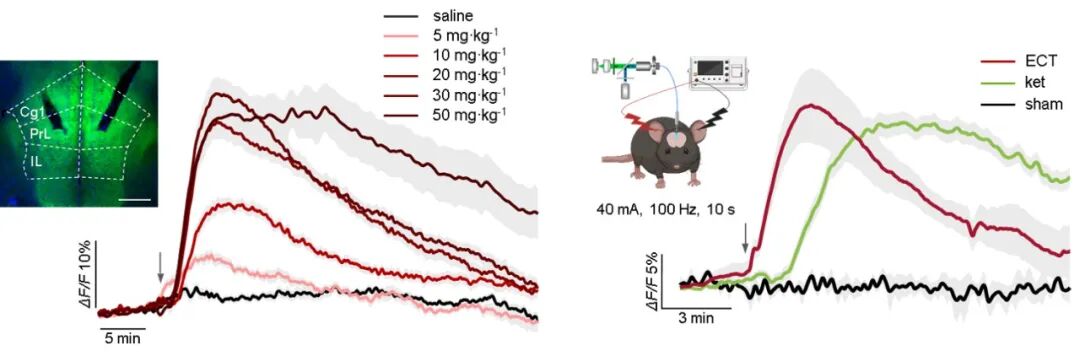Nature 专家点评:罗敏敏团队首次揭示两种强效抗抑郁疗法背后的共同机制,提出颠覆传统治疗手段