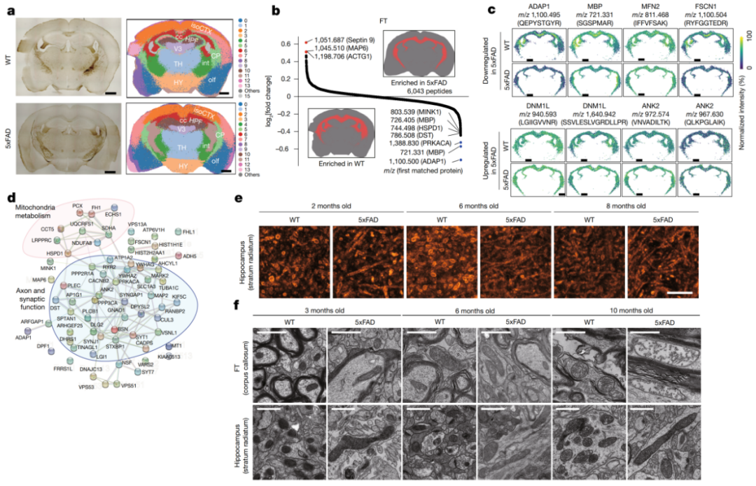 Nature：西湖大学邹贻龙团队合作开发微米级蛋白质组学成像新技术