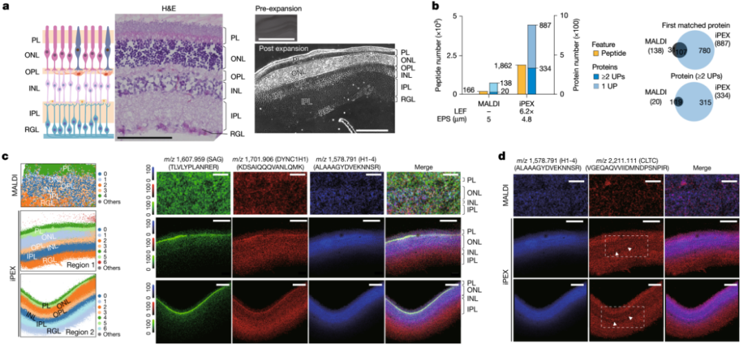 Nature：西湖大学邹贻龙团队合作开发微米级蛋白质组学成像新技术