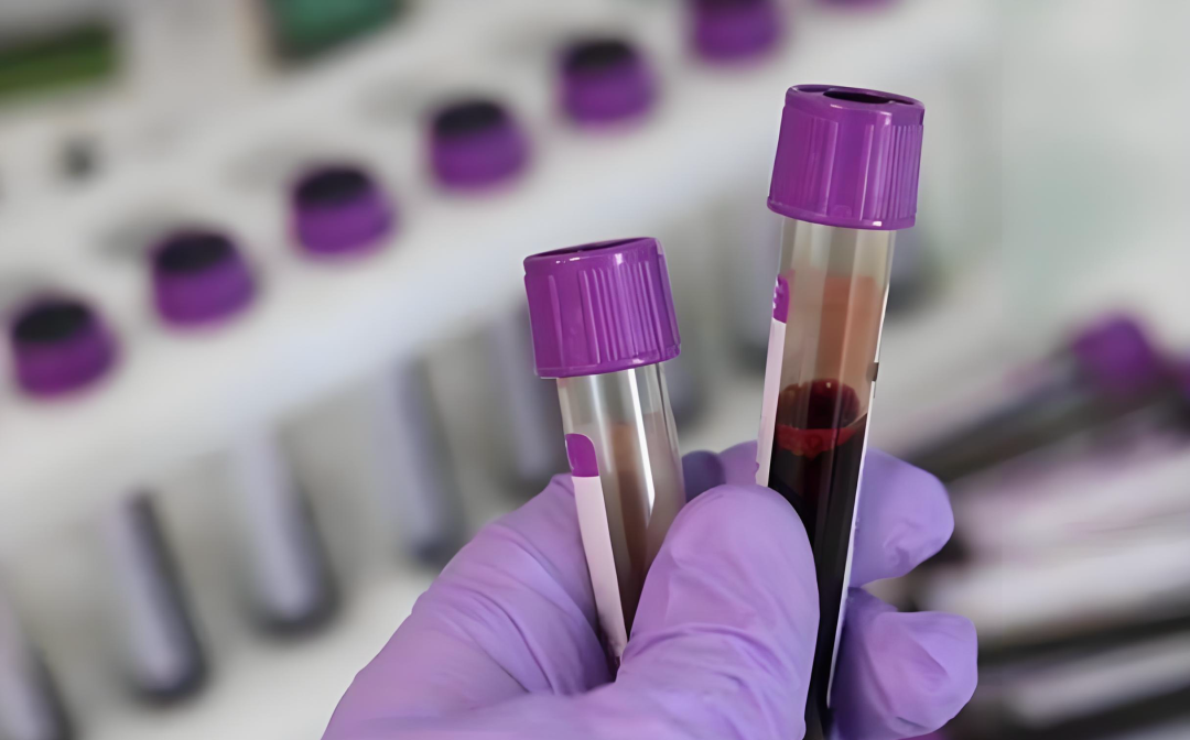 31 岁病危，竟因这份「甜蜜」？