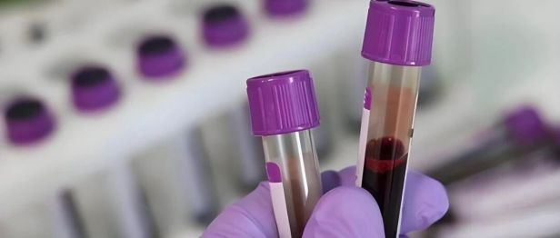 31 岁病危，竟因这份「甜蜜」？