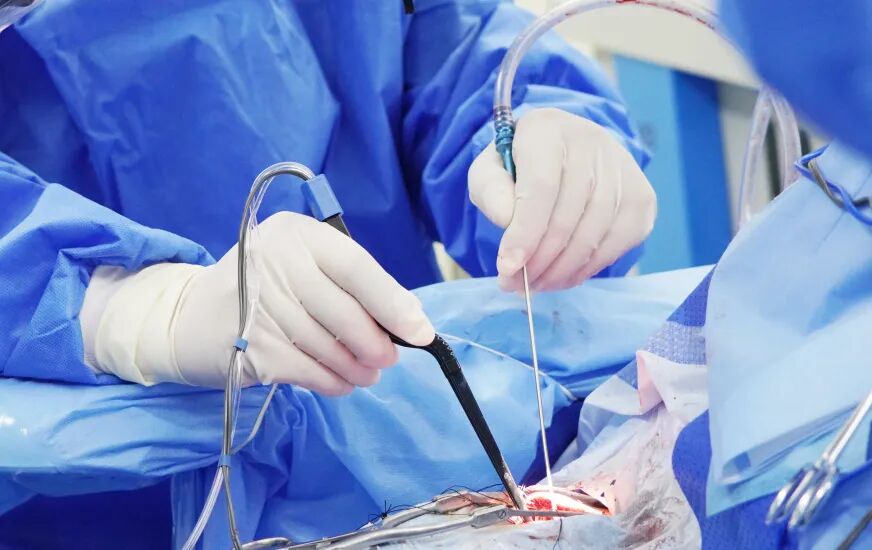 12 cm 颅骨缺口  这样被重塑