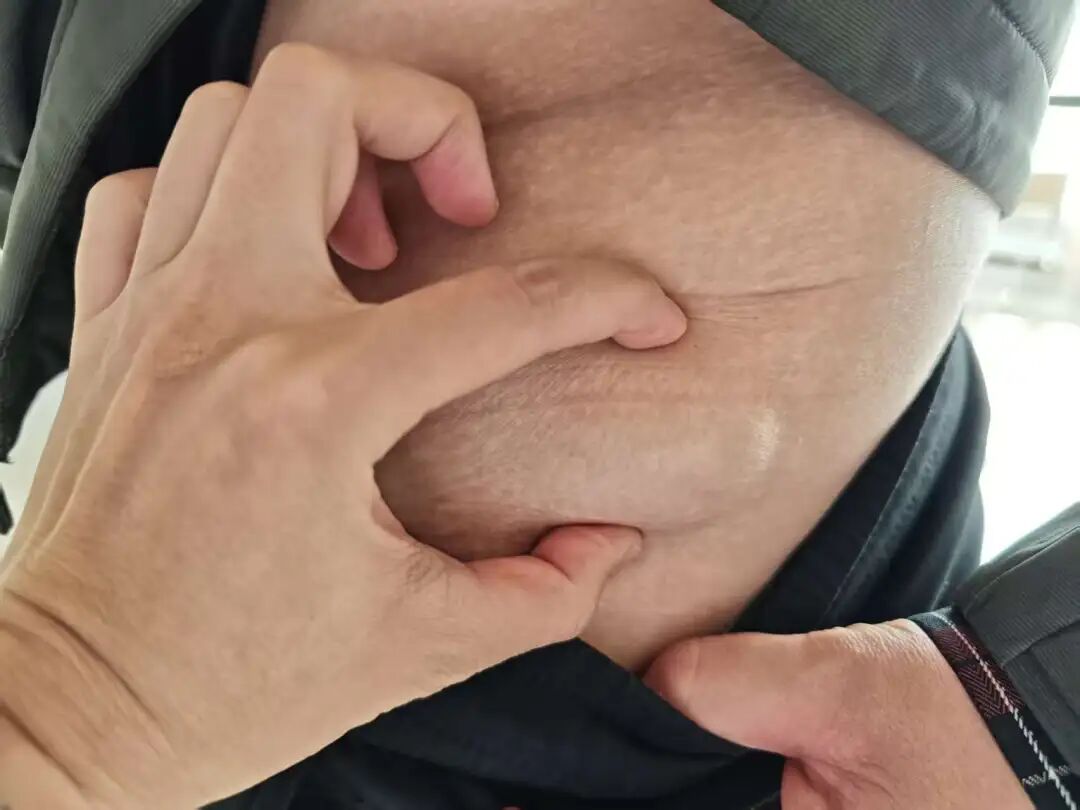 大肿块?小痕迹!新方案这样做