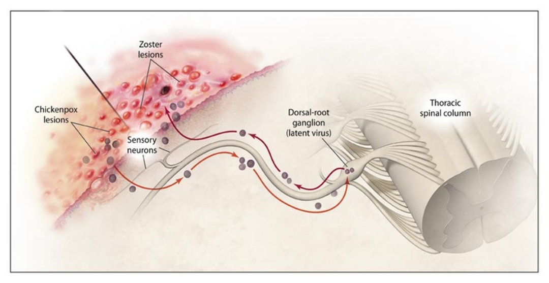 病好了还疼好几年?