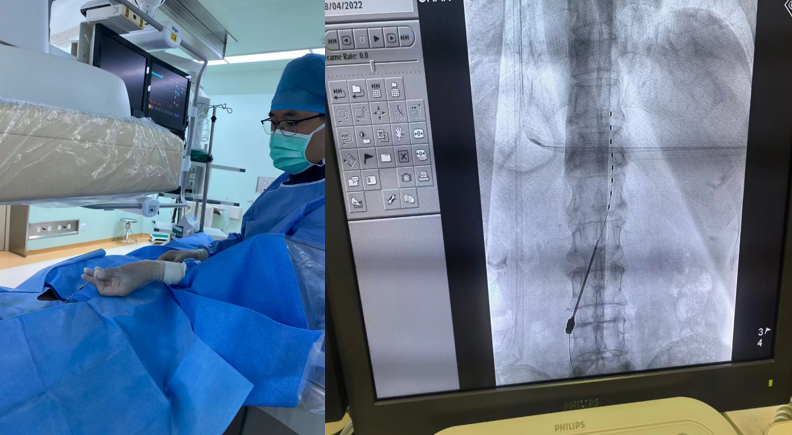 病好了还疼好几年?